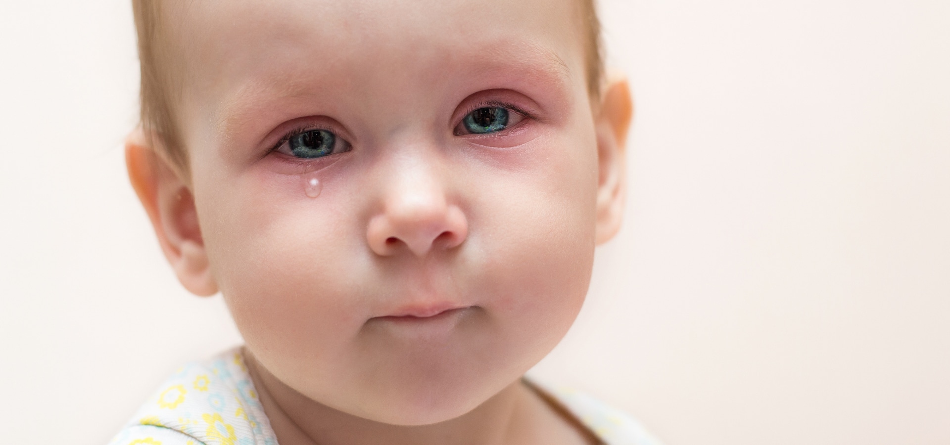 ¿Por qué pueden ponerse los ojos rojos en bebés? » ojos rojos en bebes