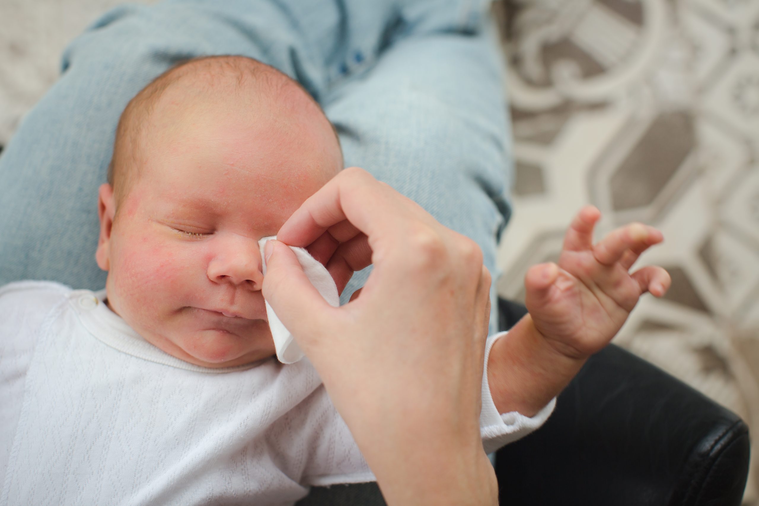 Conjuntivitis en bebés: ¿Qué tan grave es? Una guía completa para padres